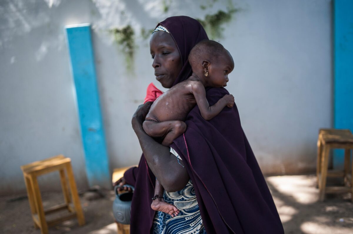 Malnourished kids in North-East