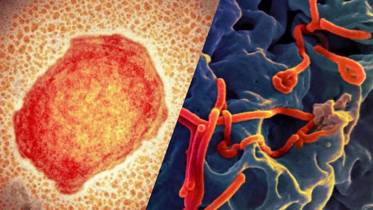 Monkeypox and Ebola