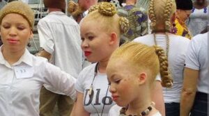 Albinos
