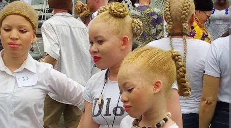 Albinos