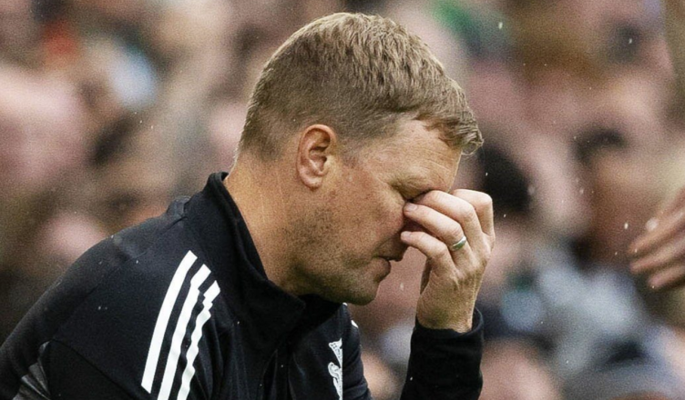 Coach Eddie Howe