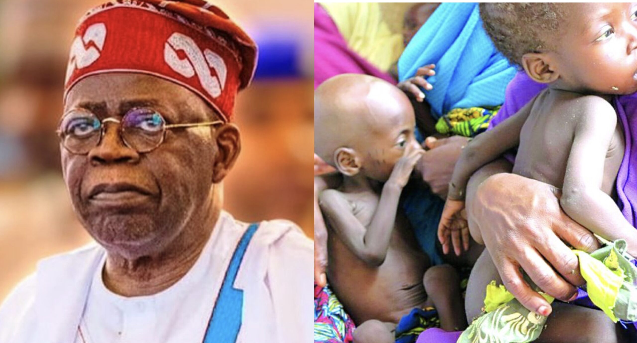 Bola Tinubu and undernourished Nigerian children