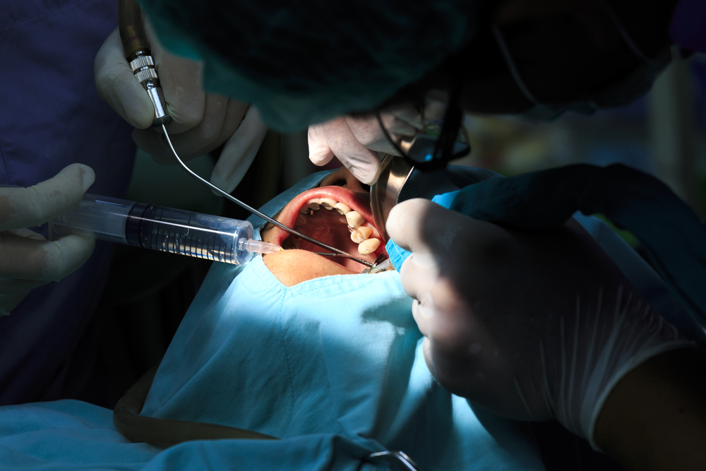 Oral_maxillofacial_Surgery
