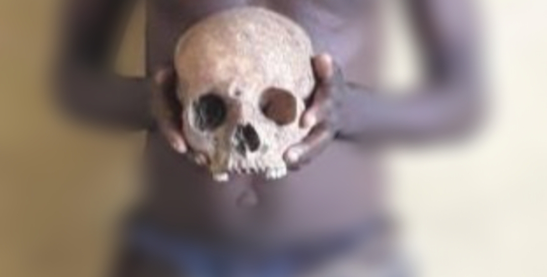 Hand holding a human skull used to illustrate this story