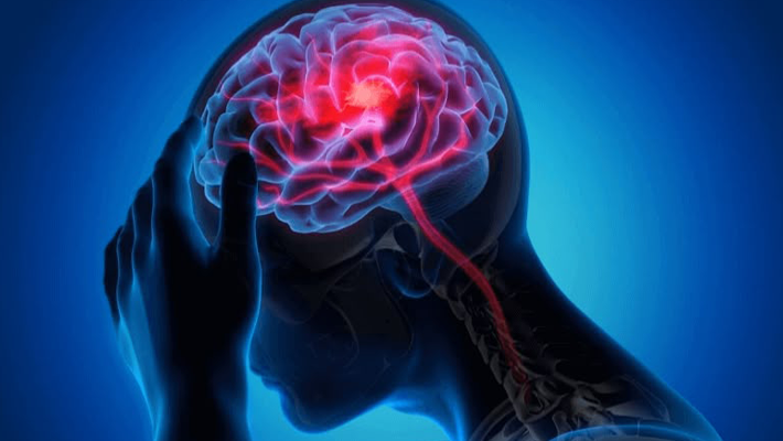 Neurological disorder