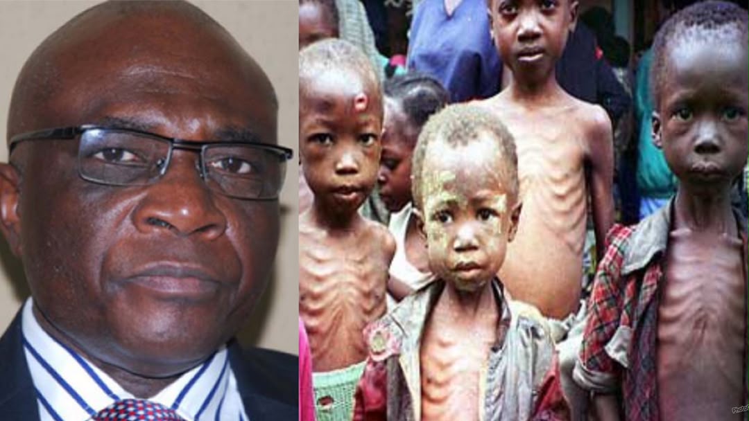 Bayo Onanuga and malnourished Nigerian kids