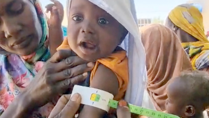 Malnourished children in North Darfur, Sudan.