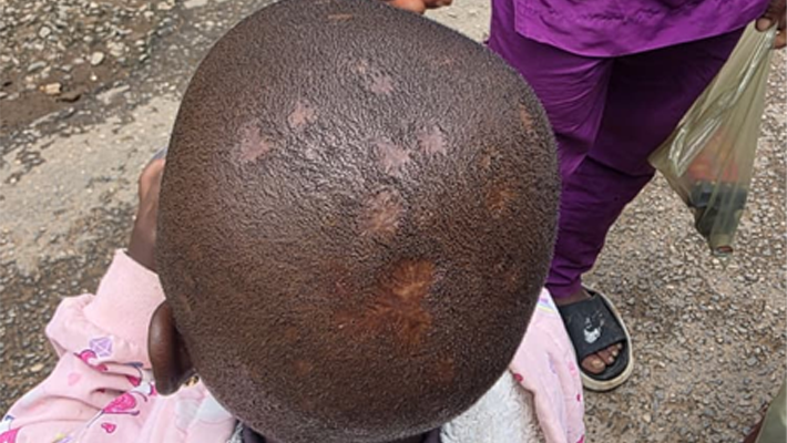 Bello has a head full of scars and bald patches.