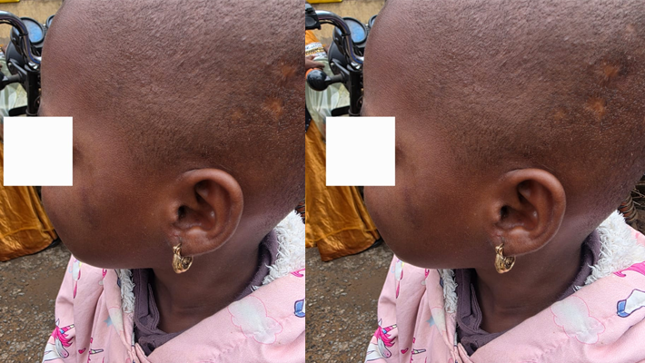 Bello, four, was hit with the barrel of a gun near her eye.