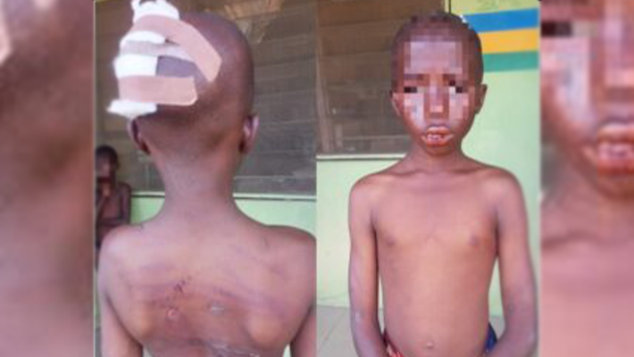 assaulted children